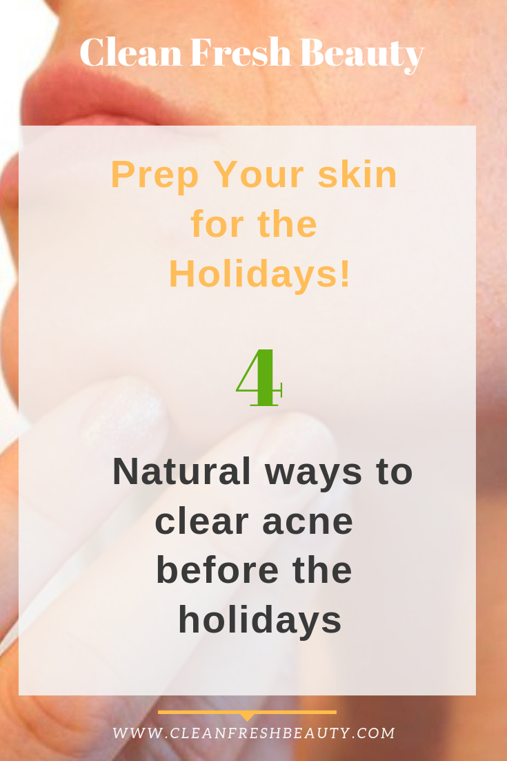 Dealing with acne? The holiday season is around the corner. There are many natural ways to clear acne before the festive season. In this blog post, I share with you natural ways to clear acne. Click to read more... #greenbeauty #natutalskincare #acne #clearacne #blemishes 
